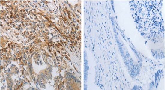 PECAM1 Rabbit Polyclonal Antibody