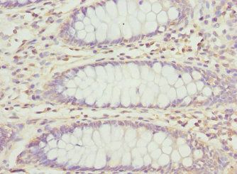 PECR Antibody