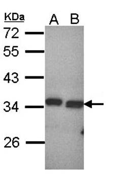 PECR Rabbit Polyclonal Antibody