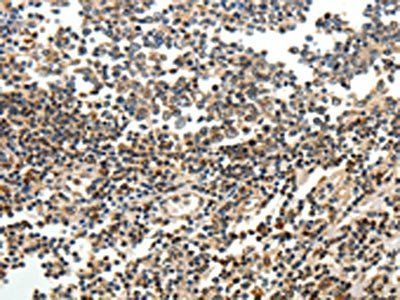SERPINF1 Antibody