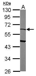 PEDF antibody