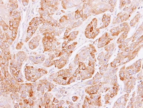 PEF1 antibody [N2C3]