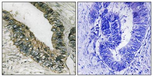PEK/PERK (Ab-981) Antibody