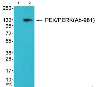 PEK/PERK antibody