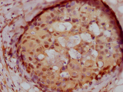 PELP1 Recombinant Monoclonal Antibody