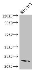 PEMT Antibody