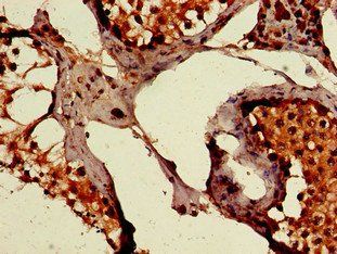 PEPD Antibody