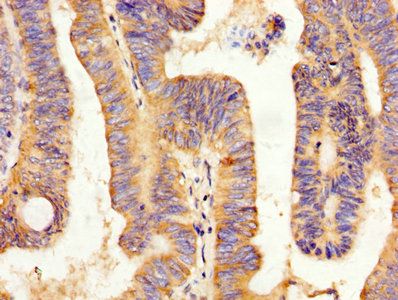 PYY Antibody