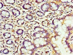 Peptidyl-prolyl cis-trans isomerase FKBP3 antibody