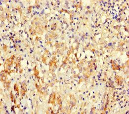 Peptidyl-tRNA hydrolase ICT1, mitochondrial antibody