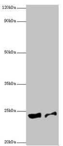 Peptidyl-tRNA hydrolase ICT1, mitochondrial antibody