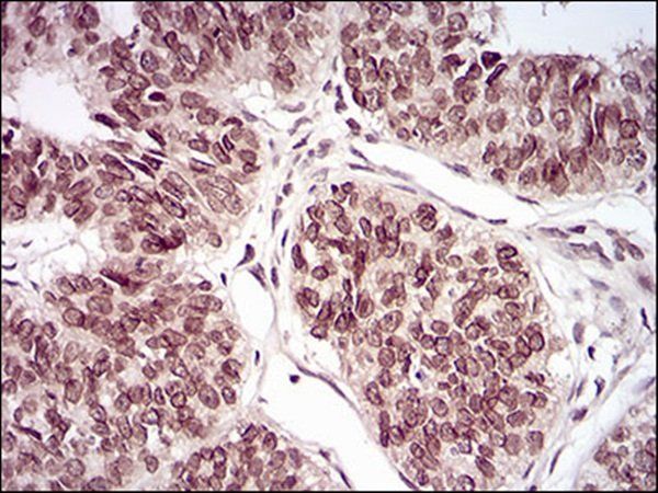 PER3 Antibody