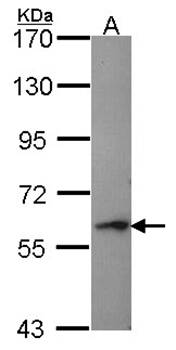 Perforin 1 Rabbit Polyclonal Antibody