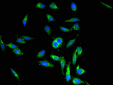 POSTN Antibody