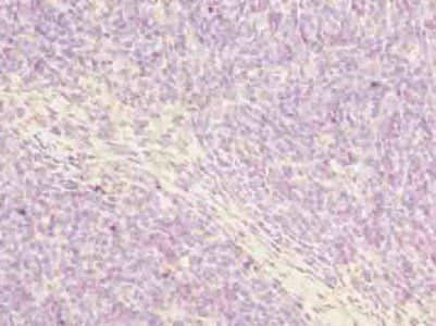 POSTN Antibody