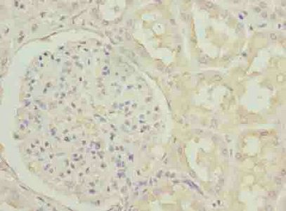 POSTN Antibody