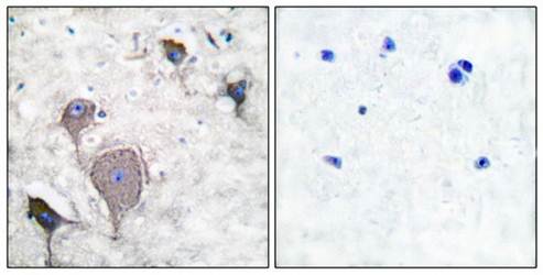 Peripherin Antibody