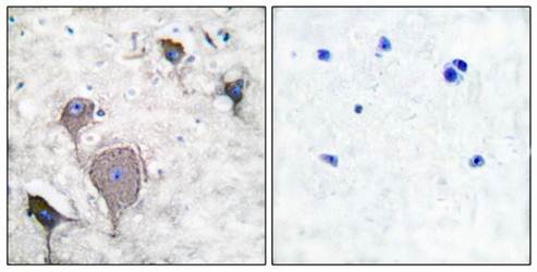 Peripherin antibody