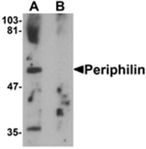 Periphilin Rabbit Polyclonal Antibody
