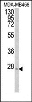 PEX11A antibody