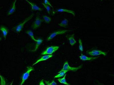 PEX11B antibody