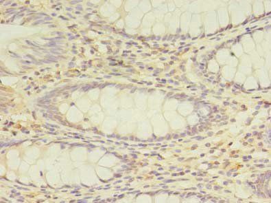 PEX11B Antibody