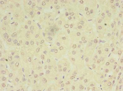 PEX11B Antibody