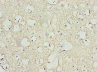 PEX14 Antibody