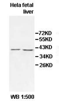 PEX14 Rabbit Polyclonal Antibody