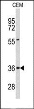 PEX16 antibody