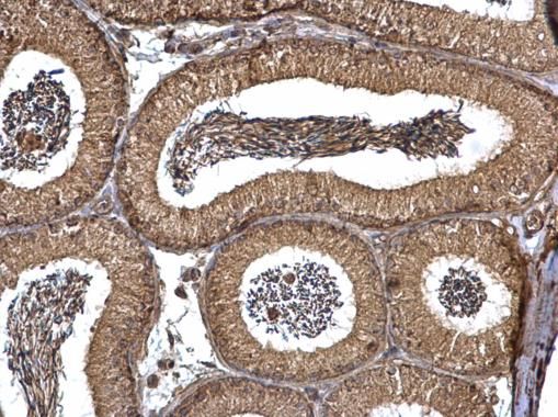 peroxisomal biogenesis factor 19 Antibody