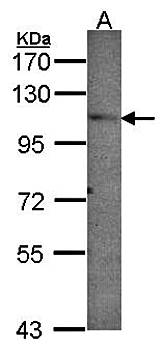 PEX6 Rabbit Polyclonal Antibody