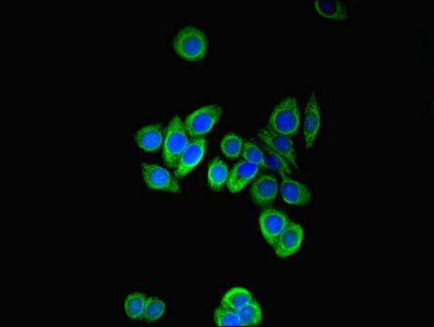 PFDN2 Antibody