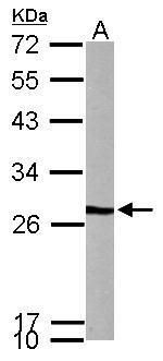 VHL binding protein 1 Antibody