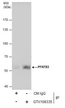 PFKFB3 antibody