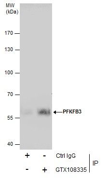 PFKFB3 antibody [C3], C-term