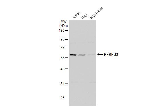 PFKFB3 antibody [C3], C-term