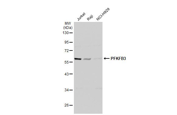 PFKFB3 antibody