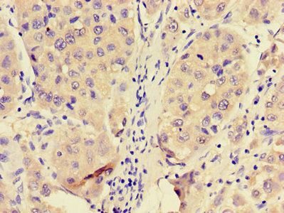 PFKL Antibody