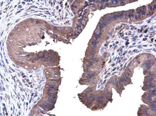PFKL antibody [C1C3]