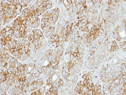 PFKL antibody [C1C3]