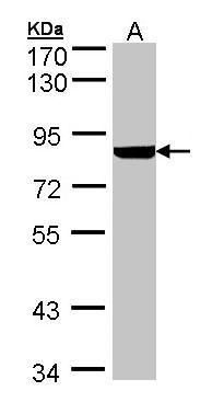 PFKL antibody [C1C3]