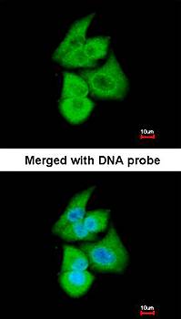 PFKL antibody