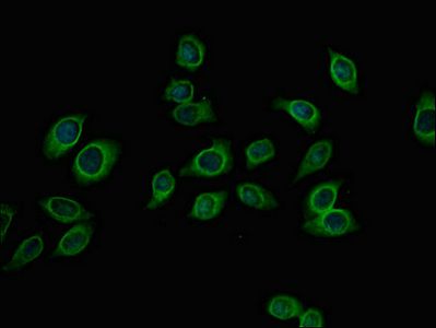PFKM Antibody