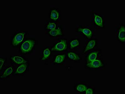 PFKM antibody