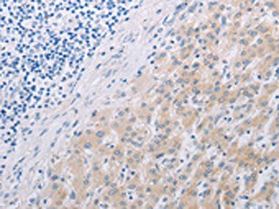PFN2 Antibody