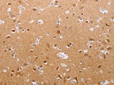 PFN2 Antibody