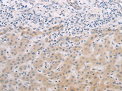 PGA3/PGA4/PGA5 Antibody