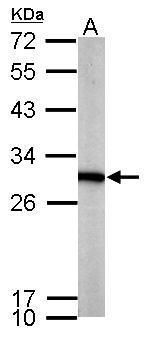 phosphoglycerate mutase 1 Antibody