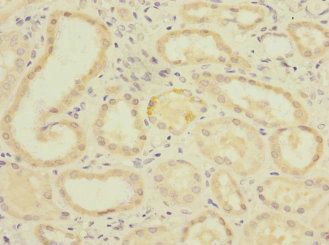 PGAM2 Antibody